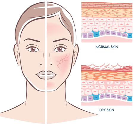 sci-skin-dry-illustration.jpg